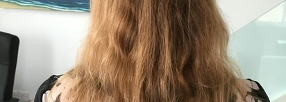 Как я спасала волосы после комы