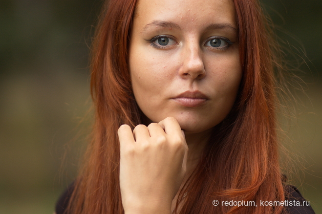 Больше 10 лет с проблемной кожей. Как я борюсь с акне