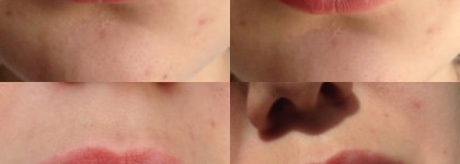 Clinique Chubby Stick #7