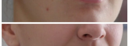 Незаменимый помощник в борьбе с неровным тоном, тусклым цветом лица и воспалениями - Ultraceuticals Even Skintone Serum