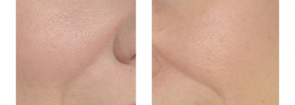 Какой тональник хамелеонит, или битва люкса By Terry и Jane Iredale