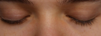 Secret Key Gold Racoony Hydro Gel Eye & Spot Patch