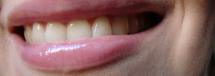 Бустеры Artdeco Hydra Lip Booster № 38, 28, 36, 46