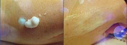 Пресловутые «пустые баночки»: четыре лидера и один аутсайдер