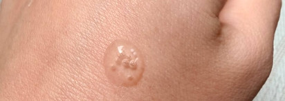 Легче легкого: Skin1004 Madagascar Centella tone brightening capsule