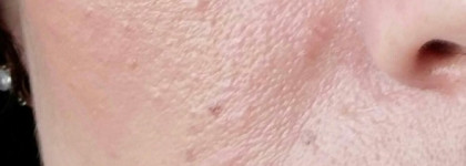 Чудо-крем -спасение мой кожи Noreva Xerodiane Plus Nutri-Baume