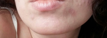 Чудо-крем -спасение мой кожи Noreva Xerodiane Plus Nutri-Baume