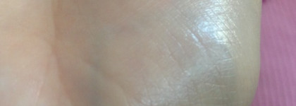 Как я боролась с обезвоживанием кожи