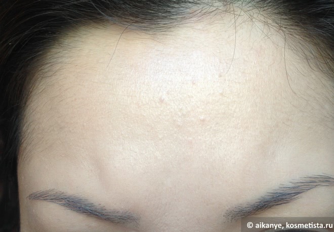 крема для обезвоженной кожи лица отзывы косметологов