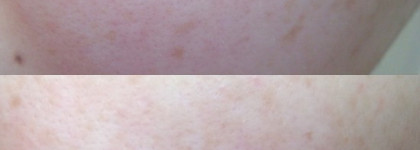 Матирующая эмульсия Avene Cleanance Mat mattifying emulsion