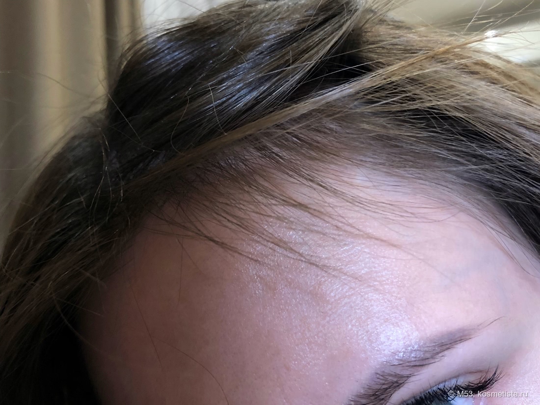 Nioxin сыворотка от выпадения волос