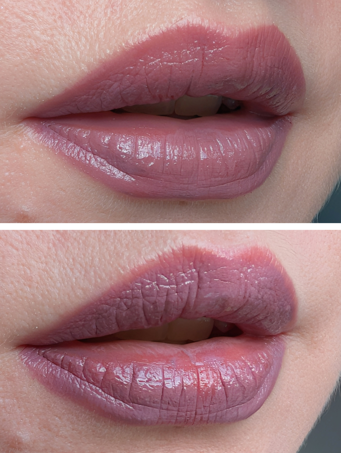 Chupa Chups Blueberry Yogurt, конфликт со слизистой