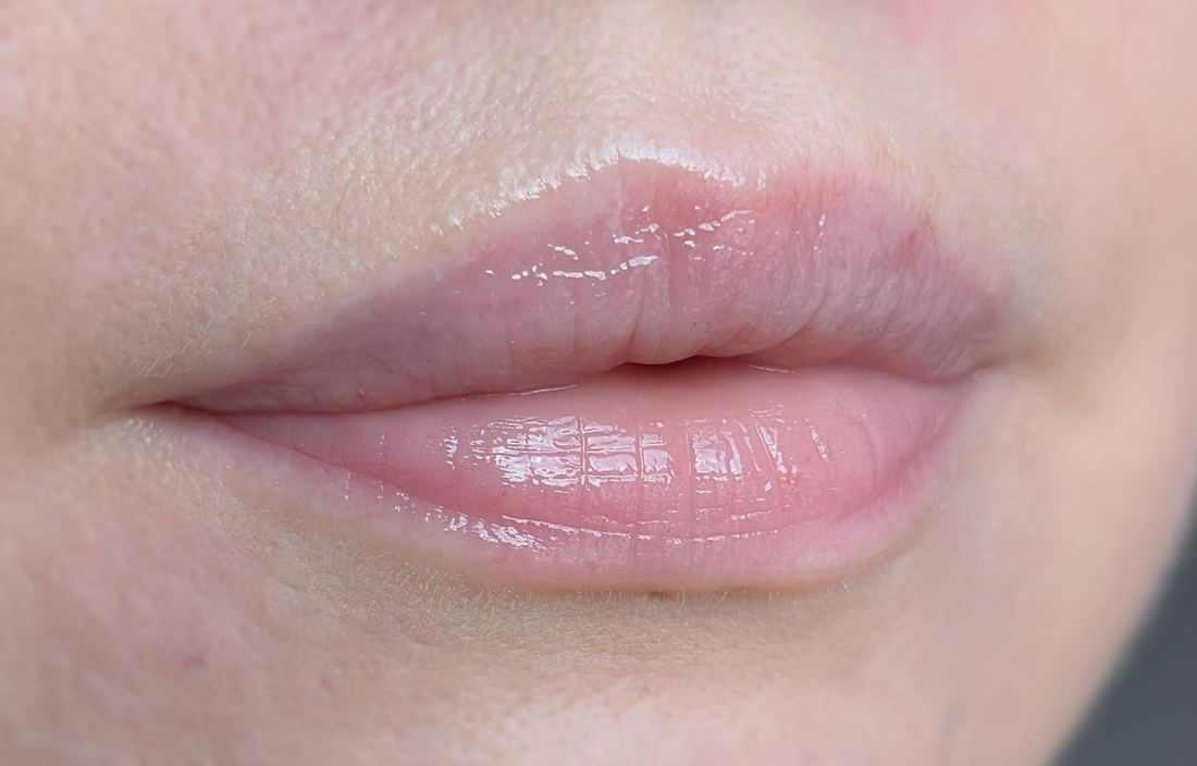 После чая с перекусом