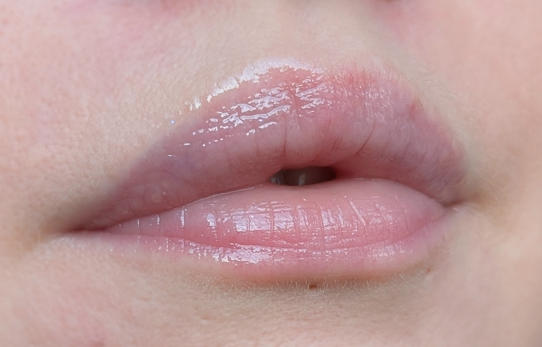 После чая с перекусом