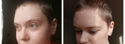 Vichy Dercos Technique Energy+ Stimulating Shampoo Complements Anti-Hair Loss Treatments