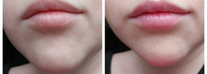 Frudia Grape Honey Essence Эссенция для губ