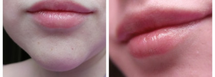 Свои губы, только лучше