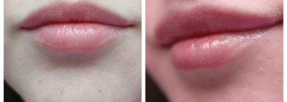 Свои губы, только лучше