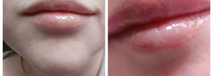 Neon Day. Beauty Bomb Lip Oil Крашиха Нереалка №01