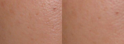 Какая разница, любовь это или дружба, когда речь идет о  Kiehl’s Micro-Blur Skin Perfector