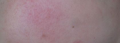 Знакомство с Mixit