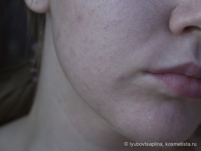 Bobbi Brown Skin Foundation SPF 15 в оттенке - Cool Beige 3.25