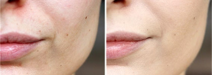 Сияющая забота о моей коже от Clarins