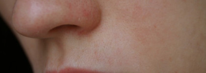 Несколько месяцев с Clarins — большой уходовый пост. От пергамента к почти здоровой коже