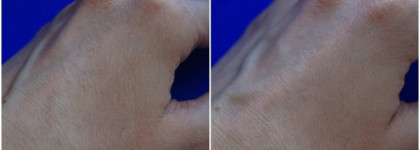 Сыворотка Limoni Snail Repair Intensive Ampoule. Как же мне с тобой повезло