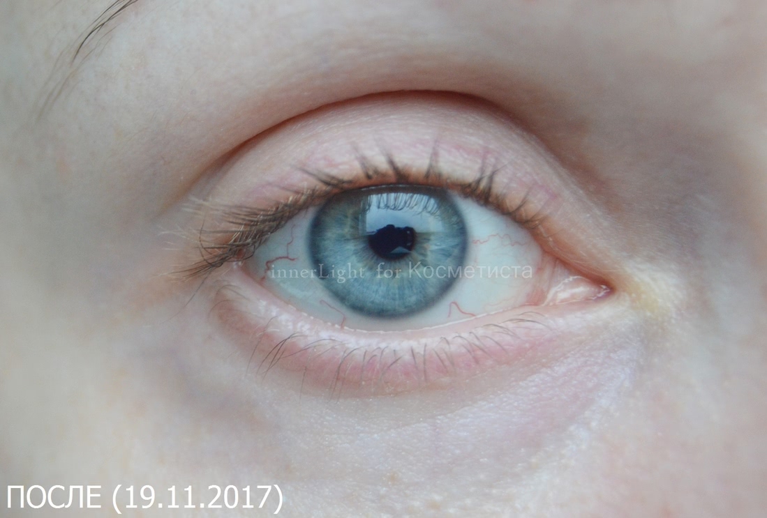 Антивозрастной крем для области вокруг глаз techni liss
