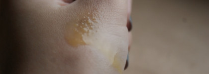 Прощай, купероз? Укрепляющий и разглаживающий концентрат с витамином С 1200 мг от Pharmaceris: до и после