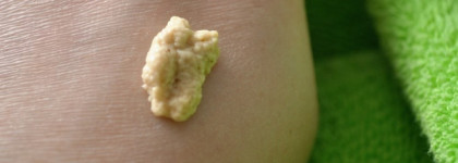 Diademine от Schwarzkopf & Henkel серия по уходу за кожей Основная программа. Пост-предупреждение