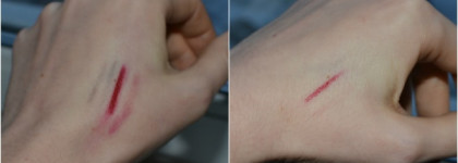 Тоник перед умыванием? Weleda One Step Cleanser & Toner (Освежающее очищающее средство 2 в 1 для нормальной и смешанной кожи)