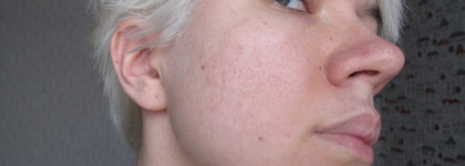 Тоник-пилинг на основе фруктовых кислот Hell pore AHA fruit toner, Elizavecca