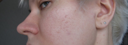 Тоник-пилинг на основе фруктовых кислот Hell pore AHA fruit toner, Elizavecca