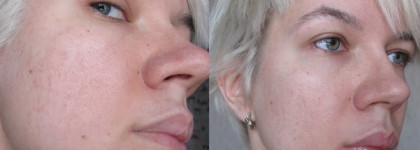 Тоник-пилинг на основе фруктовых кислот Hell pore AHA fruit toner, Elizavecca