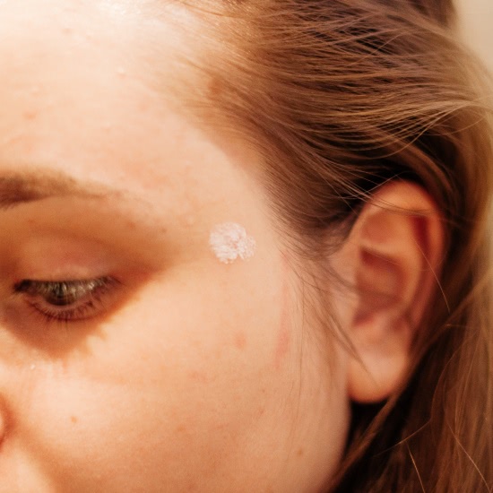 Я оду спою чудесной точечной пудре Skin Watchers от прыщей