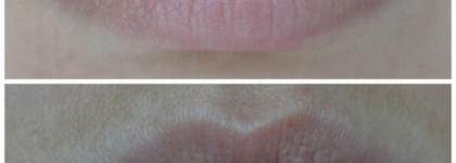 2D-Эффект с Gatineau DefiLift 3D Perfect Design Revolumising Lip Care