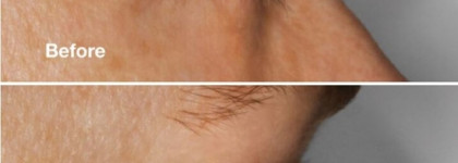 Clinique High Impact Lash Amplifying Serum