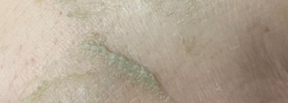 Kate Somerville ExfoliKate Intensive Exfoliating Treatment