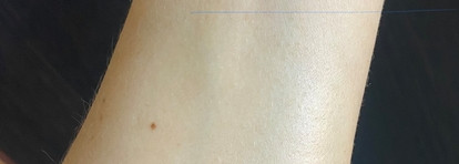 Don't Touch My Skin: отшелушивающий лосьон с ВНА и мягкий гель для умывания