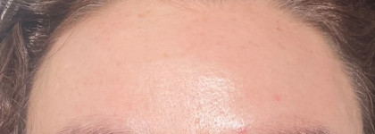Гельтек Anti acne Матирующий флюид