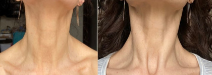 PRAI Ageless Throat & Decolletage Creme