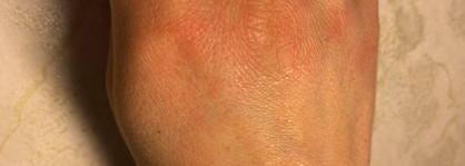 La Roche-Posay Восстанавливающий крем для сухой кожи рук Lipikar Xerand
