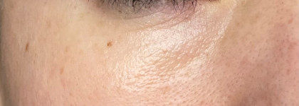 Очередное провальное средство от d'Alba - Double Serum All In One Multi Balm