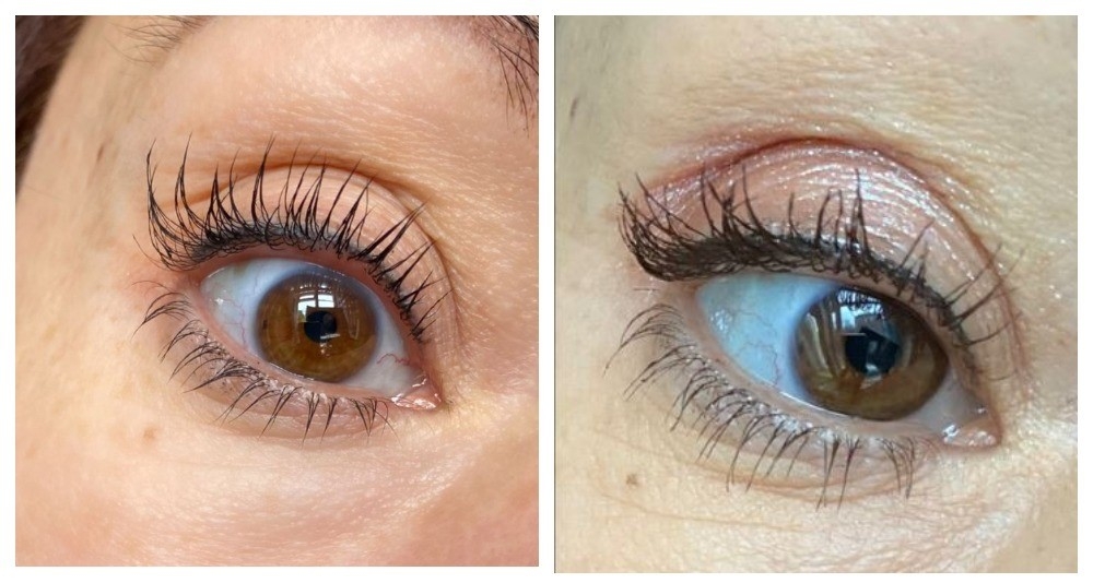 Слева - ДО (июль 2025), справа - ПОСЛЕ (ноябрь 2025) - месяц использования крема