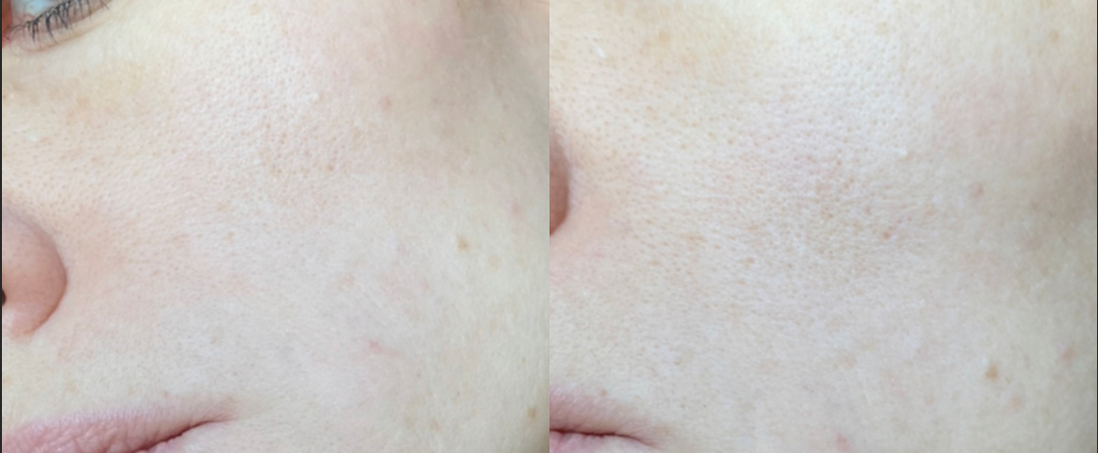 Слева – кожа до нанесения, справа - на кожу нанесён праймер тонким слоем