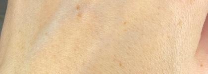 Нашумевший Celimax Retinal Shot Tightening Booster - работает или просто очередной хайп?