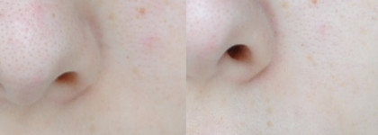 В поисках идеального "очищателя" -  L'oreal Paris гель для умывания бесконечная свежесть