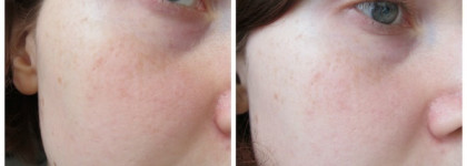 Ударная доза увлажнения, упругая и бархатная кожа - это всё так просто с кремом AlpStories Rose moisturizing face